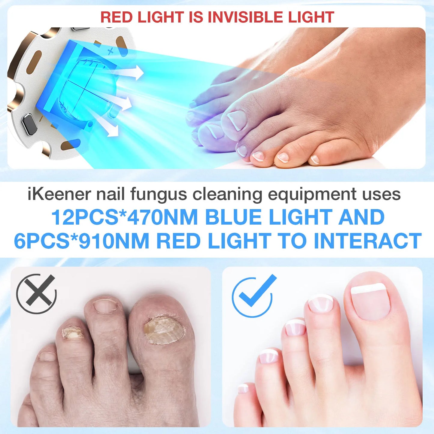 KTS Semi-arc Nail Fungus Laser Device